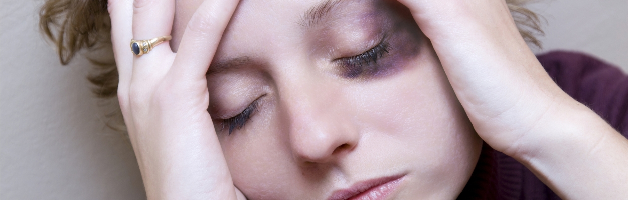 Woman with black eye