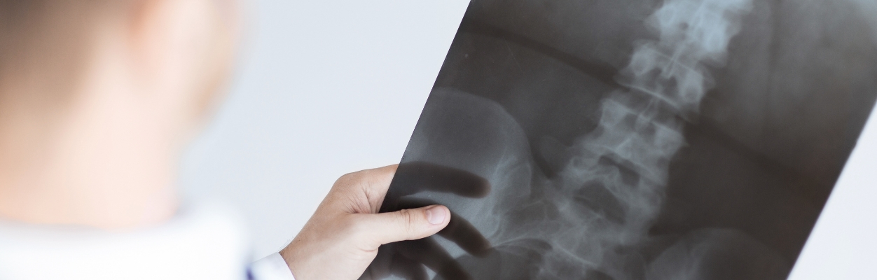 X ray of spinal cord